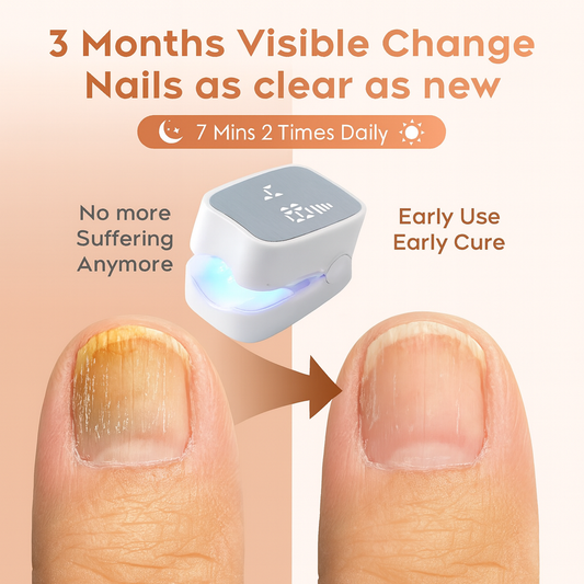 VivaNails™ – Nail Fungus Laser