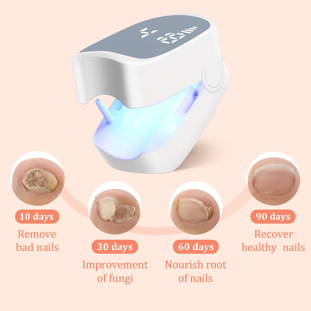VivaNails™ – Nail Fungus Laser